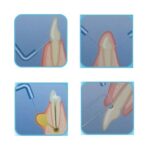 الکتروسرجری DNH مدل Actto-50A - گالری 1