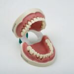 مدل تمرینی تحلیل لثه - فک پایین