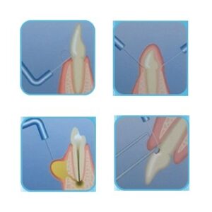 الکتروسرجری DNH مدل Actto-50RF