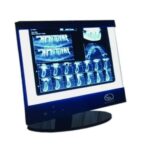 نگاتسکوپ SMed CBCT - تصویر 2