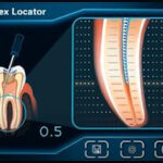 اپکس فایندر iFinder - تصویر 2